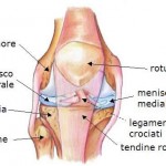 tendinite